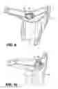 Fig. 08 - Outboard engine cowling