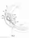 Fig. 06 - Bubble generating assembly