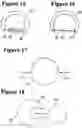 Fig. 08 - Deformable photoelastic device