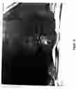 Fig. 17 - Method and composition for treating skin wounds with epidermal growth factor