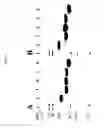 Fig. 04 - Recombinant anticoagulant proteins