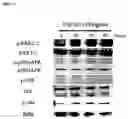 Fig. 12 - Methods of preventing and treating inflammatory bowel disease