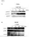 Fig. 15 - Methods of preventing and treating inflammatory bowel disease