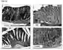 Fig. 30 - Methods of preventing and treating inflammatory bowel disease