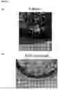 Fig. 52 - Methods of preventing and treating inflammatory bowel disease