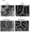 Fig. 53 - Methods of preventing and treating inflammatory bowel disease