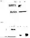 Fig. 02 - Method of extending life span