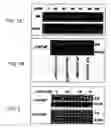 Fig. 02 - Method for treating prostate cancer using siRNA duplex for androgen receptor