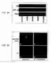 Fig. 03 - Method for treating prostate cancer using siRNA duplex for androgen receptor