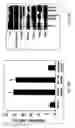 Fig. 09 - Method for treating prostate cancer using siRNA duplex for androgen receptor