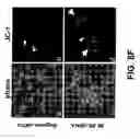 Fig. 11 - Method for treating prostate cancer using siRNA duplex for androgen receptor