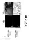 Fig. 17 - Method for treating prostate cancer using siRNA duplex for androgen receptor