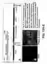 Fig. 18 - Method for treating prostate cancer using siRNA duplex for androgen receptor