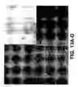 Fig. 19 - Method for treating prostate cancer using siRNA duplex for androgen receptor