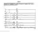 Fig. 03 - Pharmaceutical formulation for administration by inhalation comprising an androstane derivative and a beta-2-adrenoreceptor for the treatment of inflammatory and allergic conditions