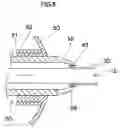 Fig. 07 - Endoscope apparatus