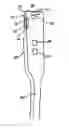 Fig. 01 - Apparatus, method and system for intravascular photographic imaging