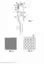 Fig. 02 - Apparatus, method and system for intravascular photographic imaging