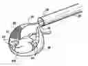 Fig. 01 - Organ retractor and method of using the same