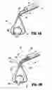 Fig. 03 - Organ retractor and method of using the same