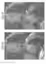 Fig. 05 - Local magnetic resonance image quality by optimizing imaging frequency