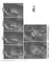 Fig. 06 - Local magnetic resonance image quality by optimizing imaging frequency