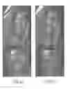 Fig. 07 - Local magnetic resonance image quality by optimizing imaging frequency