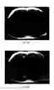 Fig. 08 - Method and apparatus for phase-sensitive magnetic resonance imaging