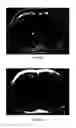Fig. 09 - Method and apparatus for phase-sensitive magnetic resonance imaging