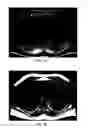 Fig. 10 - Method and apparatus for phase-sensitive magnetic resonance imaging