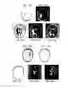 Fig. 16 - Method and apparatus for phase-sensitive magnetic resonance imaging