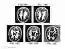 Fig. 17 - Method and apparatus for phase-sensitive magnetic resonance imaging