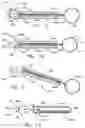 Fig. 06 - Methods and devices for defining and marking tissue