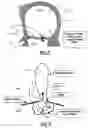 Fig. 03 - Viewing system having means for processing a sequence of ultrasound images for performing a quantitative estimation of  flow in a body organ