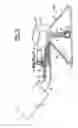 Fig. 04 - Apparatus for screening and diagnosing by dual stethoscopic and Doppler detection