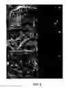 Fig. 09 - Detection of endothelial dysfunction by ultrasonic imaging