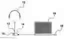 Fig. 01 - Apparatus and method for detecting the severity of brain function impairment