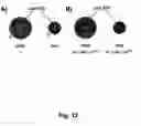 Fig. 13 - Apparatus and method for detecting the severity of brain function impairment
