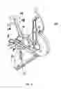 Fig. 04 - Vibrational loading apparatus for mounting to exercise equipment