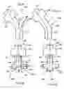 Fig. 13 - Positive pressure systems and methods for increasing blood pressure and circulation