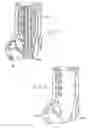 Fig. 04 - Molded orthopaedic devices