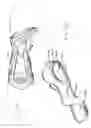 Fig. 13 - Molded orthopaedic devices