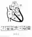 Fig. 02 - Method and apparatus for treating heart failure