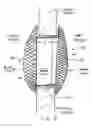 Fig. 04 - Method and apparatus for treating heart failure