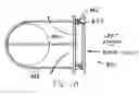 Fig. 10 - Method and apparatus for treating heart failure