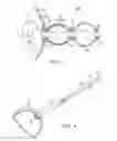 Fig. 06 - Method and apparatus for anastomosis including an expandable anchor