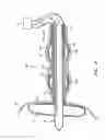 Fig. 07 - Method and apparatus for anastomosis including an expandable anchor