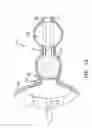 Fig. 08 - Method and apparatus for anastomosis including an expandable anchor