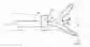 Fig. 01 - Microcatheter including swellable tip