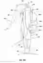 Fig. 13 - Methods of administering therapeutic injections